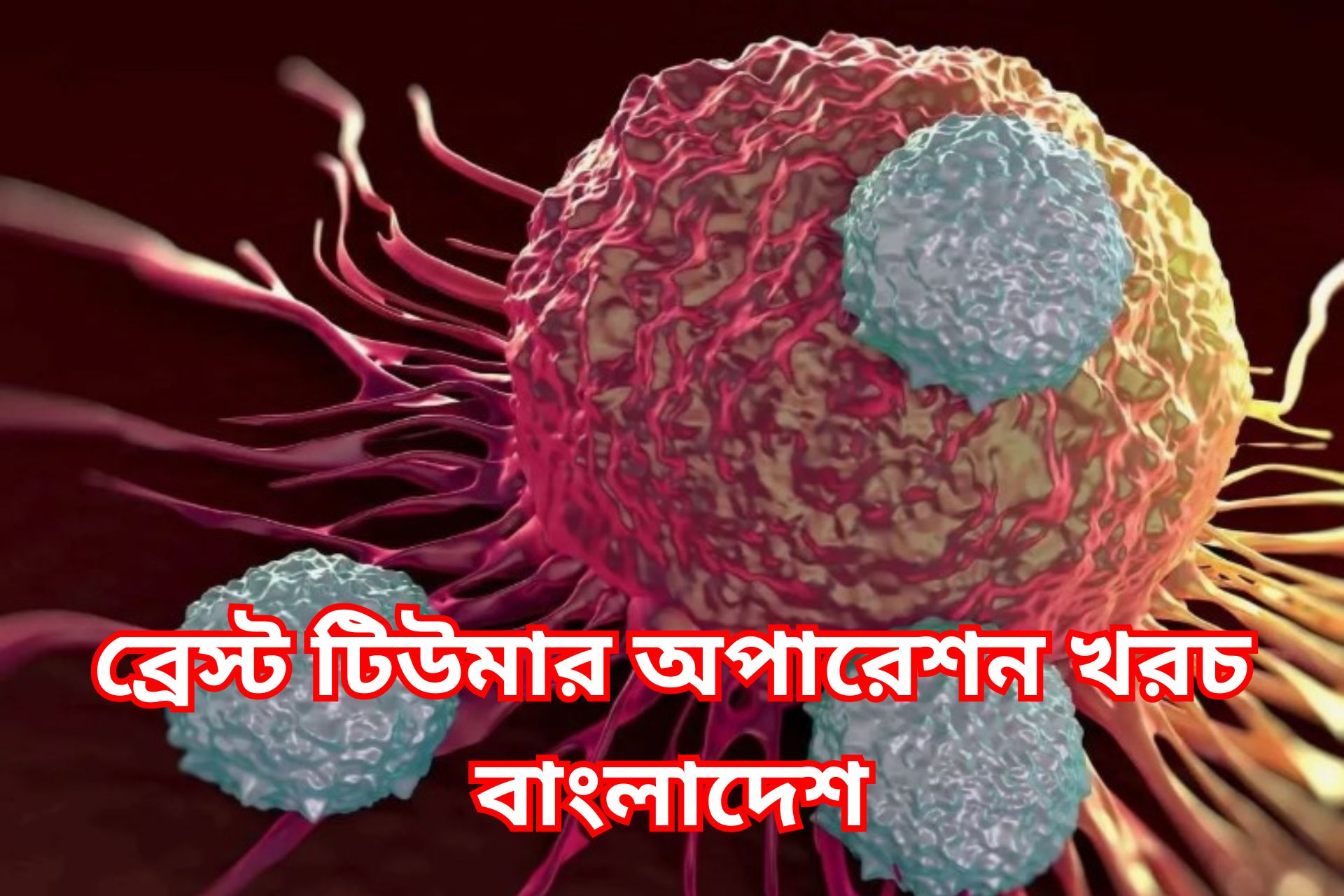 ব্রেস্ট টিউমার অপারেশন খরচ বাংলাদেশ।